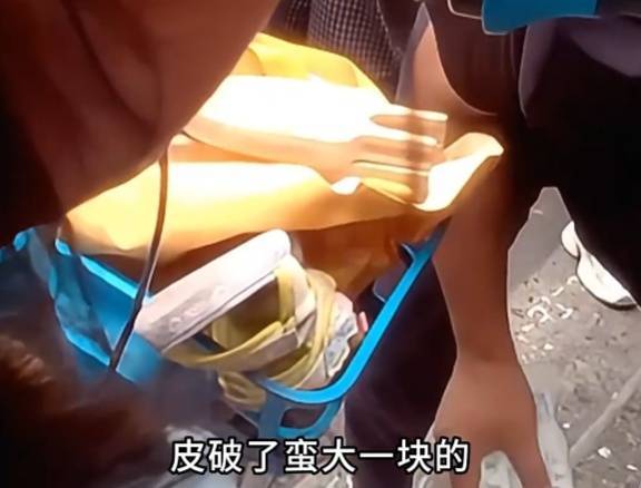 看著都疼<strong></p>
<p>西鳳酒
</strong>！上海街頭一男子突然求助：10歲女兒被死死卡??！這個行為太危險→:西鳳酒
