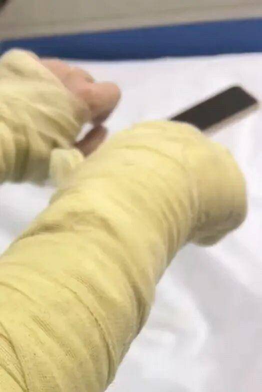 湖南一女主播被偽裝的包裹炸傷<strong></p>
<p>西鳳酒
</strong>，永州公安：正在核實(shí)具體情況:西鳳酒

