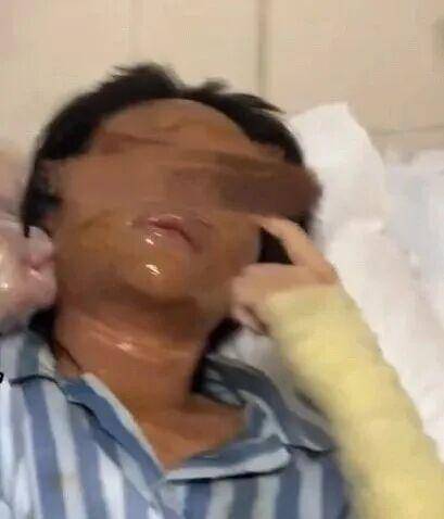 湖南一女主播被偽裝的包裹炸傷<strong></p>
<p>西鳳酒
</strong>，永州公安：正在核實(shí)具體情況:西鳳酒
