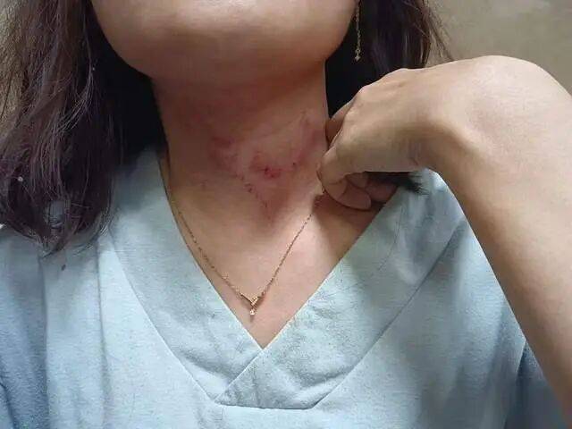 一男子凌晨聽到兩聲呼救<strong></p>
<p>西鳳酒
</strong>，循聲發(fā)現(xiàn)一女子在奔馳車外被白衣男勒昏！受害者：是受朋友之托借錢給白衣男，凌晨被騙至偏僻處遭非禮！:西鳳酒
