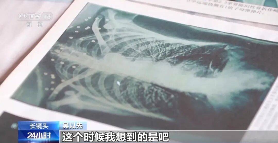 “老先生<strong></p>
<p>西鳳酒
</strong>，您把項鏈取下來再做CT”“你看是不是彈片”:西鳳酒

