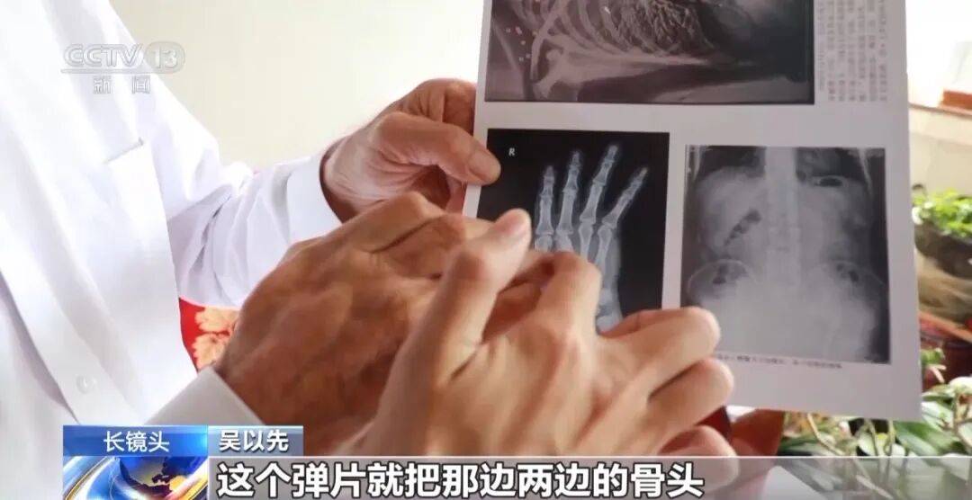 “老先生<strong></p>
<p>西鳳酒
</strong>，您把項鏈取下來再做CT”“你看是不是彈片”:西鳳酒
